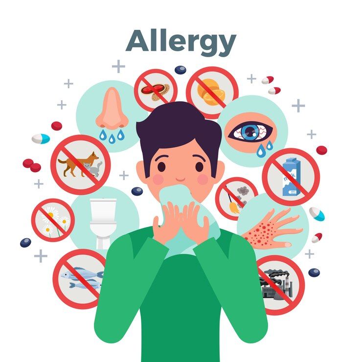 Allergies