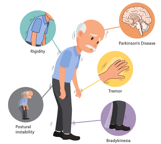 Parkinson’s Disease: Causes, Symptoms, and Home Care Solutions
