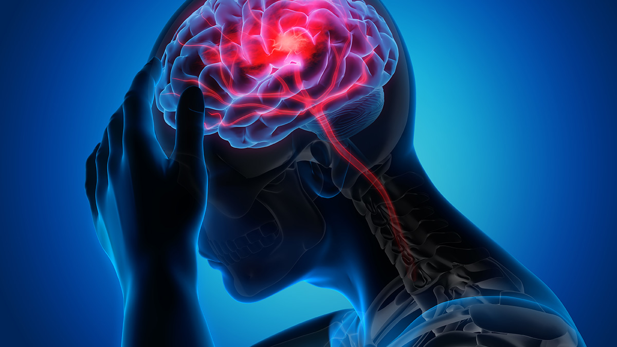 Stroke: Understanding the Causes, Symptoms, and Home Care Solutions